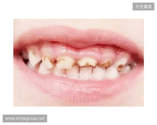 韦林顿确诊上唇部贯通伤;11、21牙半脱位;上颌前牙区牙槽骨骨折