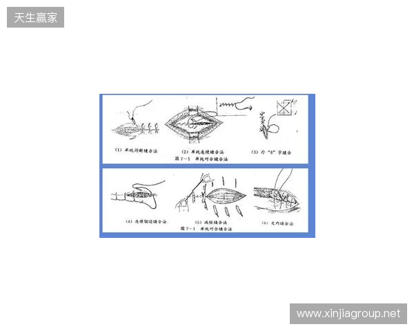 广州豹官方:杨浩眉弓伤口缝合30余针,预计5-7天后拆线 广州豹官方:杨浩眉弓伤口缝合30余针,预计5-7天后拆线
